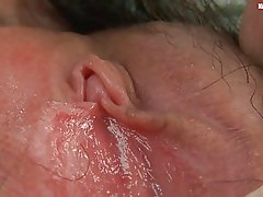 شعر المتعاقدة الآسيوية منفرداً والرطب